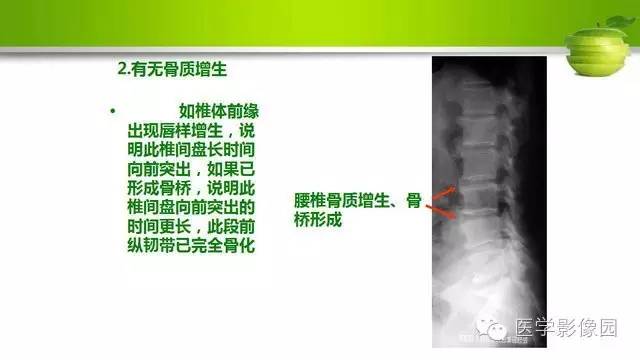 【PPT】腰椎阅片技巧