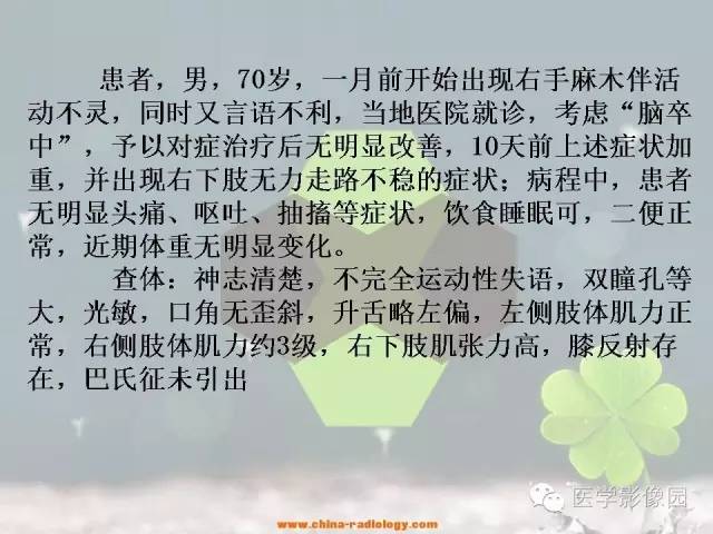 【病例】中枢神经系统淋巴瘤1例MR影像表现