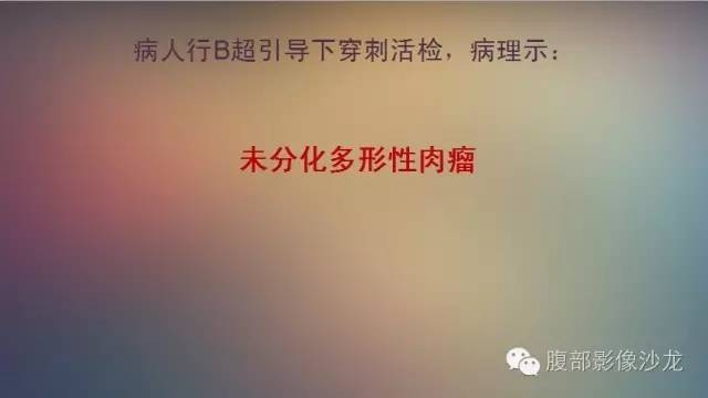 【病例】腹腔未分化多形性肉瘤1例CT影像表现 【病例】腹腔未分化多形性肉瘤1例CT影像表现