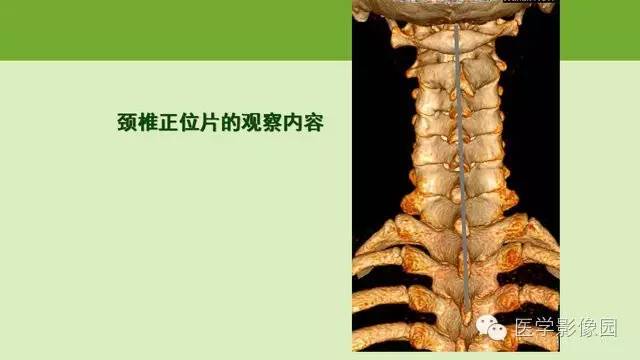 【PPT】颈椎影像阅片方法