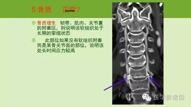 【PPT】颈椎影像阅片方法