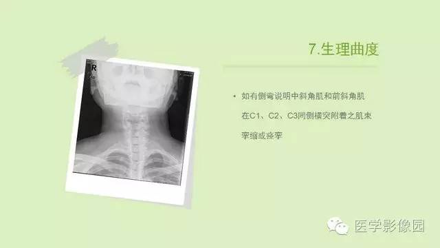 【PPT】颈椎影像阅片方法