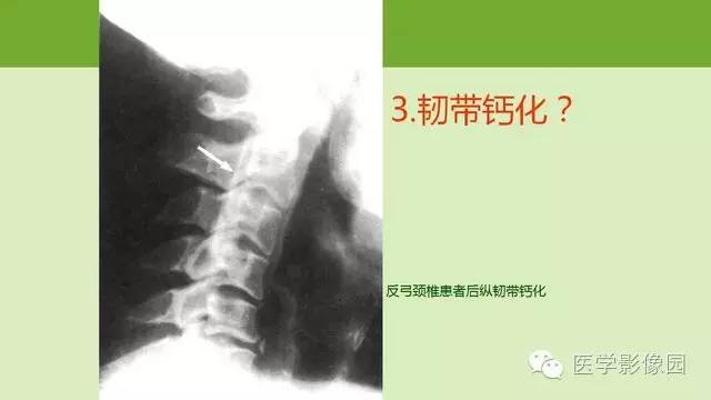 【PPT】颈椎影像阅片方法