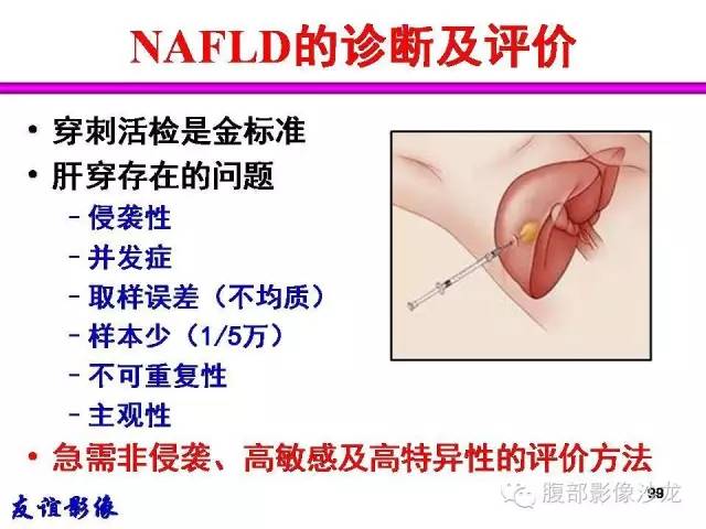 【PPT】脂肪肝CT、MRI定量分析
