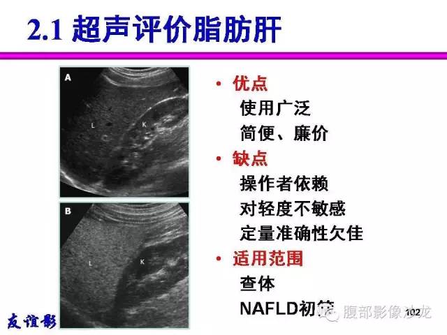 【PPT】脂肪肝CT、MRI定量分析