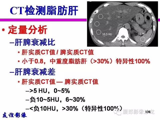 【PPT】脂肪肝CT、MRI定量分析