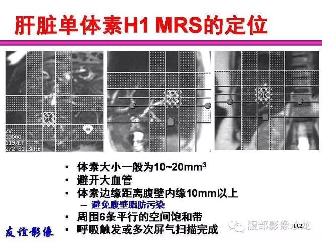 【PPT】脂肪肝CT、MRI定量分析