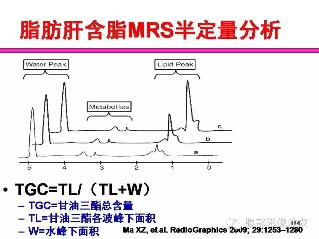 【PPT】脂肪肝CT、MRI定量分析