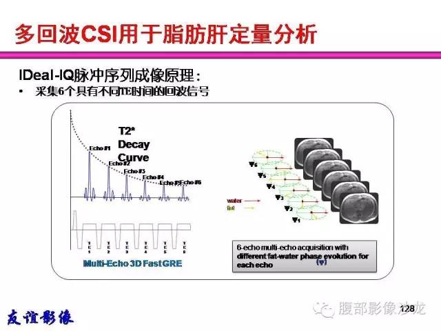 【PPT】脂肪肝CT、MRI定量分析