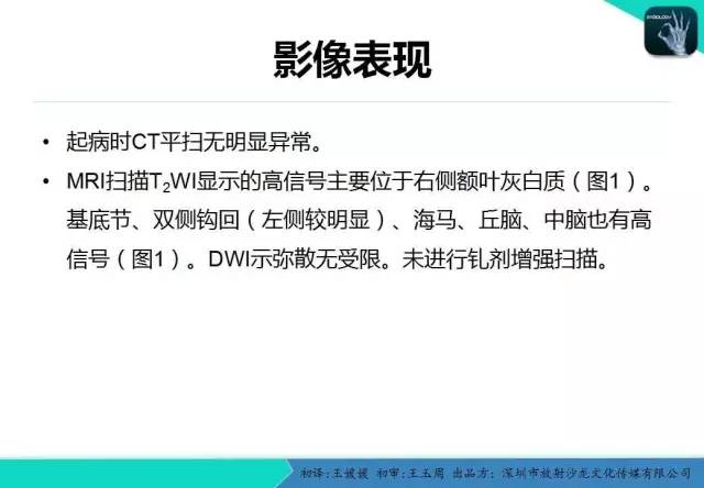 【PPT】狂犬病脑炎