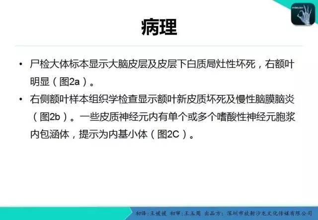 【PPT】狂犬病脑炎
