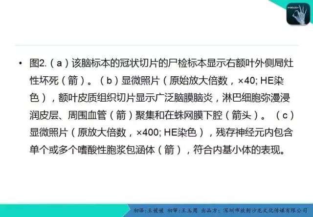 【PPT】狂犬病脑炎