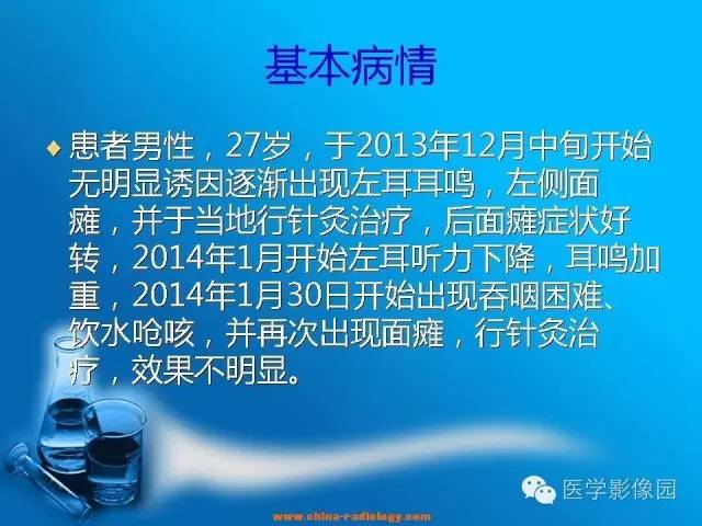 【病例】左侧桥小脑角区淋巴瘤1例MR影像表现 【病例】左侧桥小脑角区淋巴瘤1例MR影像表现