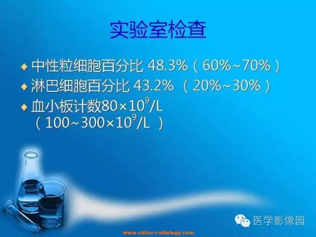 【病例】左侧桥小脑角区淋巴瘤1例MR影像表现 【病例】左侧桥小脑角区淋巴瘤1例MR影像表现