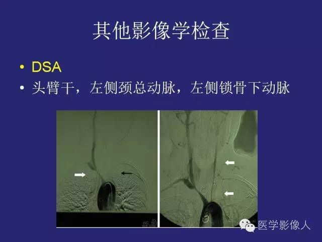 【PPT】大动脉炎分型及CT诊断