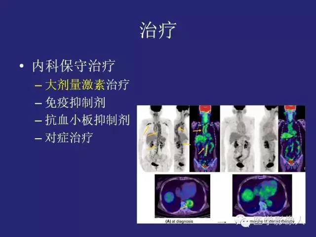 【PPT】大动脉炎分型及CT诊断