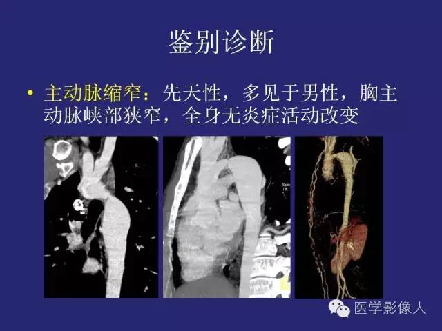 【PPT】大动脉炎分型及CT诊断