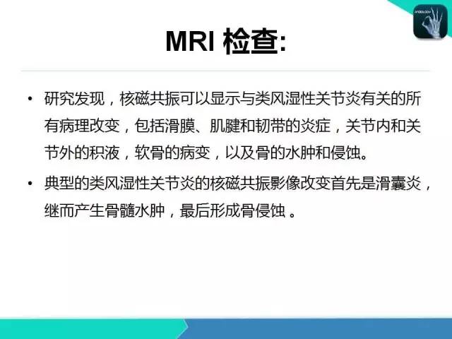 【PPT】类风湿性关节炎