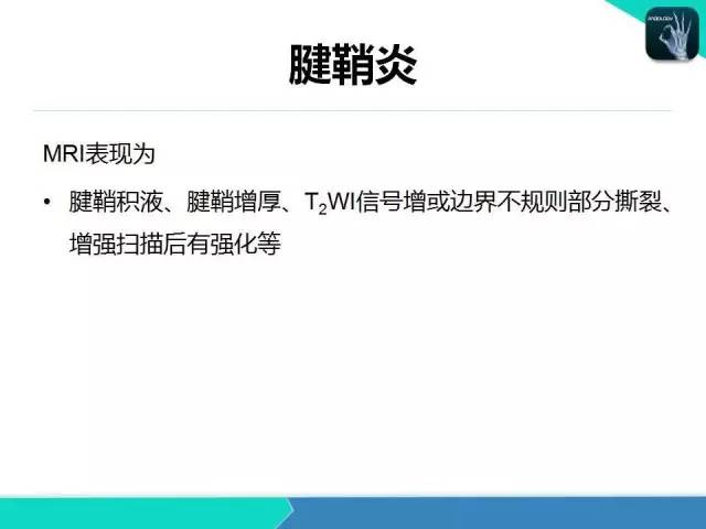 【PPT】类风湿性关节炎