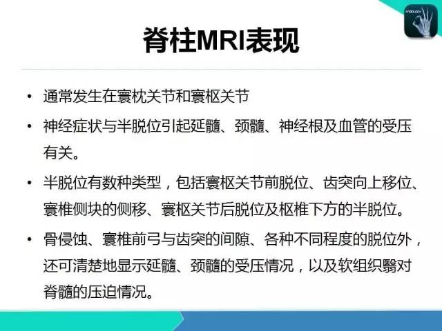 【PPT】类风湿性关节炎