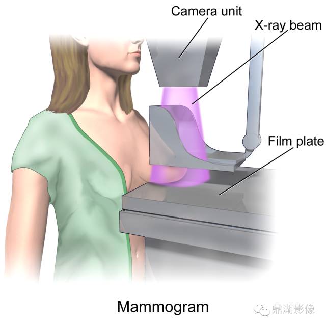 一篇搞定乳腺X线摄影检查及诊断 一篇搞定乳腺X线摄影检查及诊断