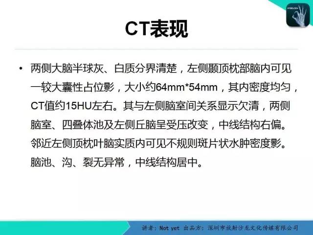 【病例】室管膜瘤一例MR影像表现