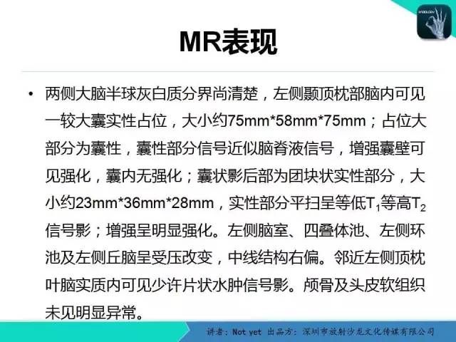 【病例】室管膜瘤一例MR影像表现