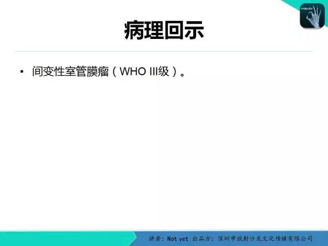 【病例】室管膜瘤一例MR影像表现
