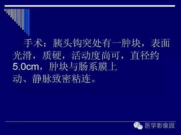 【病例】胰腺女儿瘤—实性假乳头状瘤1例CT影像表现