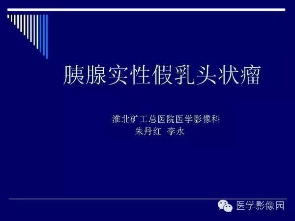 【病例】胰腺女儿瘤—实性假乳头状瘤1例CT影像表现
