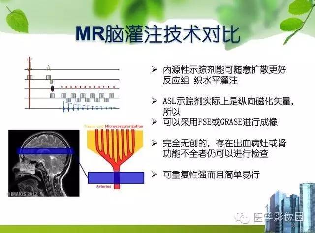 【PPT】磁共振ASL灌注成像在神经系统的应用