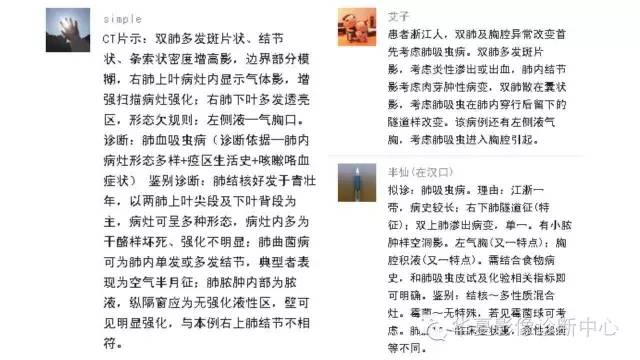【病例】肺吸虫病1例CT影像表现