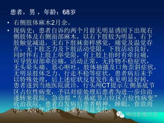 【病例】左侧基底节区血管畸形合并出血一例