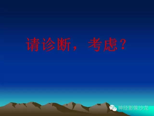 【病例】左侧基底节区血管畸形合并出血一例