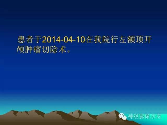 【病例】左侧基底节区血管畸形合并出血一例