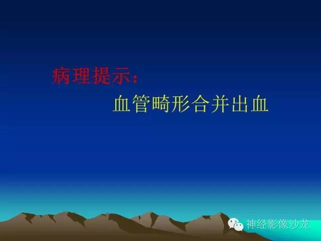 【病例】左侧基底节区血管畸形合并出血一例