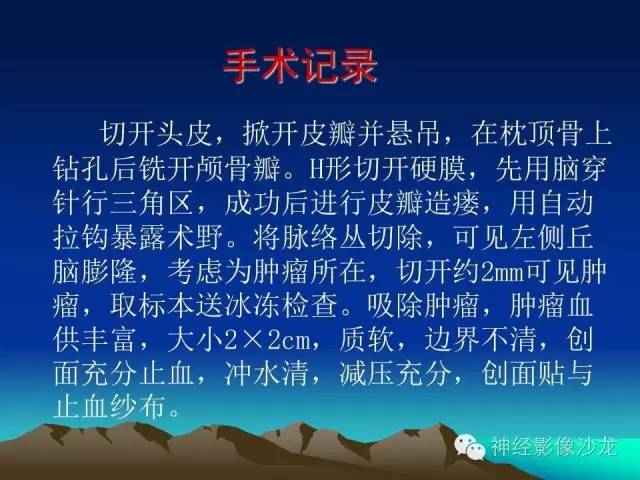 【病例】左侧基底节区血管畸形合并出血一例