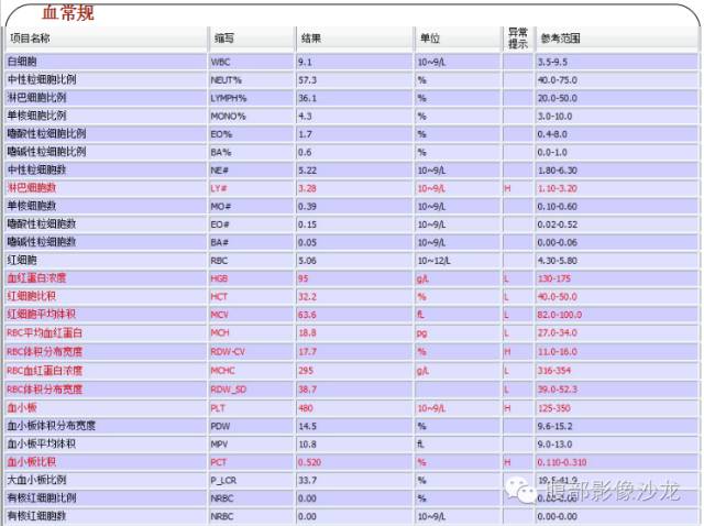 【病例】糖原累积症肝型伴肝腺瘤1例CT 【病例】糖原累积症肝型伴肝腺瘤1例CT
