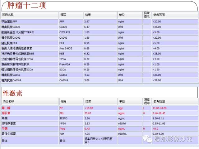【病例】糖原累积症肝型伴肝腺瘤1例CT 【病例】糖原累积症肝型伴肝腺瘤1例CT