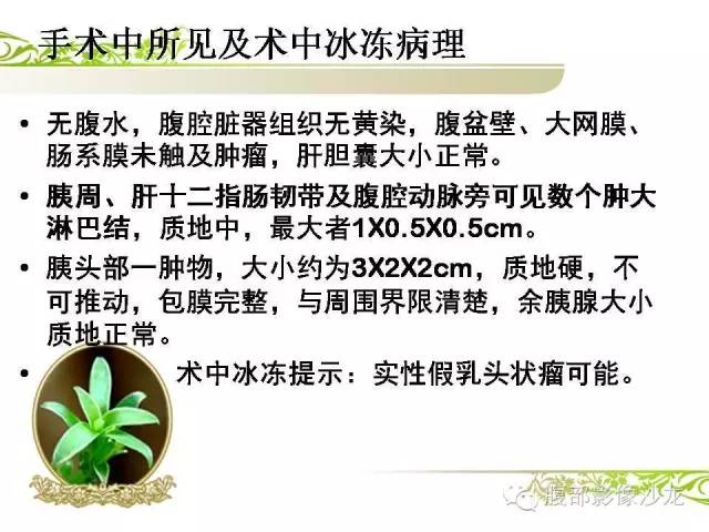 【病例】胰腺神经内分泌瘤1例CT影像表现
