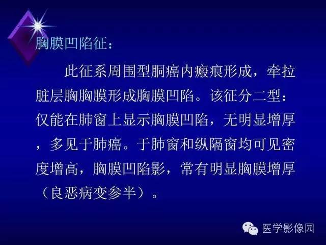 【PPT】几种CT征象对周围型肺癌的影像诊断价值