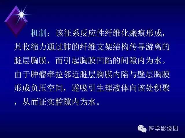 【PPT】几种CT征象对周围型肺癌的影像诊断价值