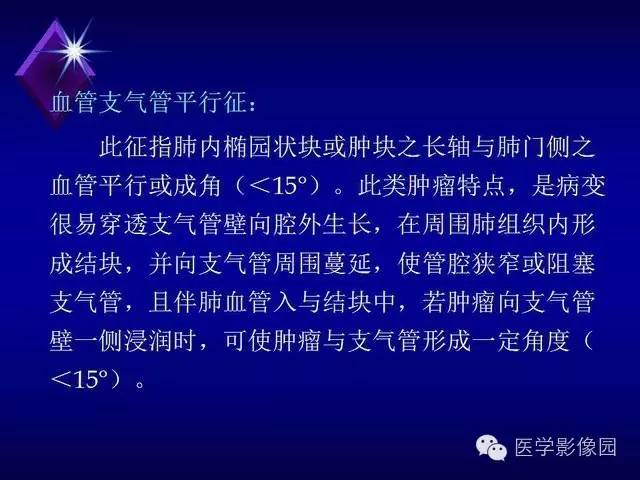 【PPT】几种CT征象对周围型肺癌的影像诊断价值