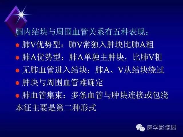 【PPT】几种CT征象对周围型肺癌的影像诊断价值