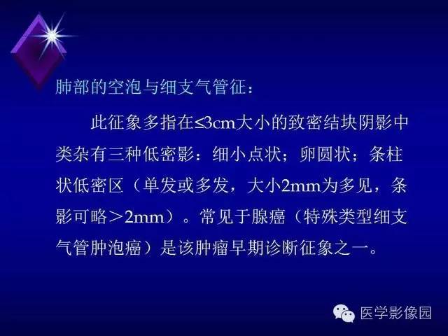 【PPT】几种CT征象对周围型肺癌的影像诊断价值