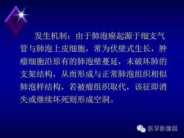 【PPT】几种CT征象对周围型肺癌的影像诊断价值