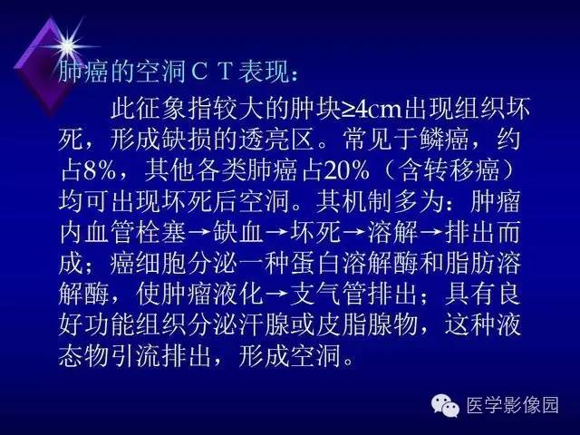 【PPT】几种CT征象对周围型肺癌的影像诊断价值