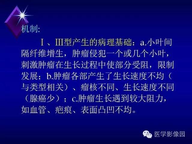 【PPT】几种CT征象对周围型肺癌的影像诊断价值
