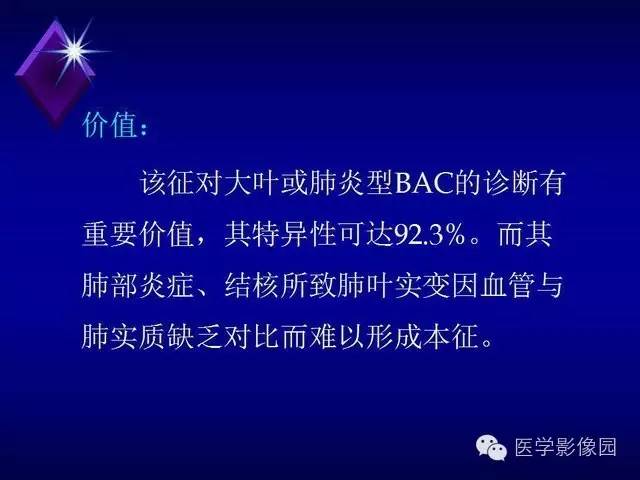 【PPT】几种CT征象对周围型肺癌的影像诊断价值