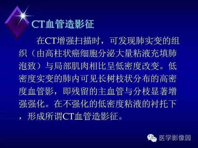 【PPT】几种CT征象对周围型肺癌的影像诊断价值